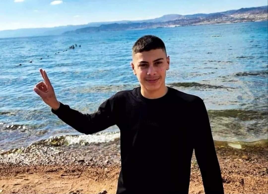استشهاد الفتى محمد ابو اسنينة متأثرا بإصابته في القدس