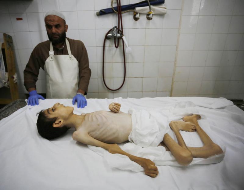 استشهاد طفل نتيجة التجويع في قطاع غزة